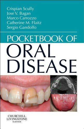 download Pocketbook of Oral Disease - E-Book